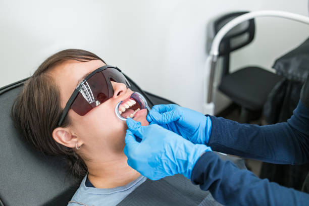Best Emergency Wisdom Tooth Extraction in Seal Beach, CA
